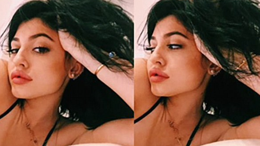 De här bilderna raderade Kylie från sin Instagram efter rykten om att hon skulle ha opererat sina läppar.